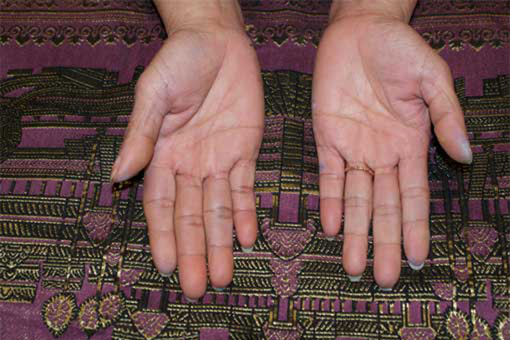 Digital Stories Project – Rany Bun-Ranihands